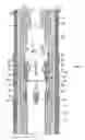 Fig. 02 - Casing coupler liner hanger mechanism