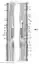 Fig. 04 - Casing coupler liner hanger mechanism