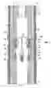 Fig. 09 - Casing coupler liner hanger mechanism