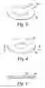 Fig. 04 - Method for Making an Injection-Moulded Abrasive Article