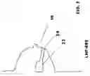 Fig. 03 - EXTRACELLULAR MATRIX  AS SURGICAL ADJUNCT IN A LUMPECTOMY PROCEDURE