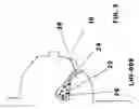 Fig. 04 - EXTRACELLULAR MATRIX  AS SURGICAL ADJUNCT IN A LUMPECTOMY PROCEDURE