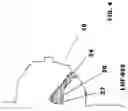 Fig. 05 - EXTRACELLULAR MATRIX  AS SURGICAL ADJUNCT IN A LUMPECTOMY PROCEDURE