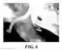 Fig. 07 - Bioherbicide from spp