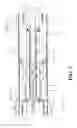Fig. 03 - Blood Flow Bypass Catheters and Methods for the Delivery of Medium to the Vasculature and Body Ducts