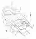 Fig. 07 - Blood Flow Bypass Catheters and Methods for the Delivery of Medium to the Vasculature and Body Ducts