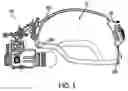 Fig. 02 - Method and Apparatus for Mounting a Vision System