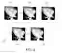 Fig. 07 - Iterative Image Reconstruction of a Moving Object From Projection Data