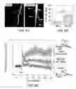 Fig. 09 - Compositions and Methods Relating to Mitochondrial Hyperpolarization in Neurological Disease