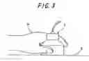 Fig. 04 - Thermotherapy Device