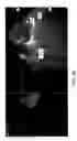 Fig. 06 - Automatic detection and quantification of plaque in the coronary arteries of subjects from CT scans
