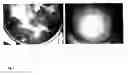 Fig. 02 - Chimeric flaviviruses