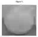 Fig. 08 - HYDROGELS AND HYDROGEL PARTICLES