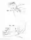 Fig. 06 - Patch for Transdermal Drug Delivery