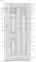 Fig. 01 - Nestable molded articles, and related assemblies and methods