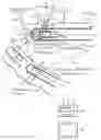 Fig. 01 - Device for X-ray brachytherapy, and method for positioning a probe introduced into a body for X-ray brachytherapy