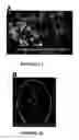 Fig. 02 - Fluorescent chlorotoxin conjugate and method for intra-operative visualization of cancer