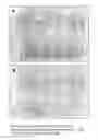 Fig. 07 - Extracts of Latex of Calotropis Procera and to a Method of Preparation Thereof