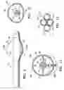 Fig. 04 - Methods for asymmetrical irradiation of a body cavity