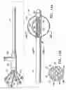 Fig. 06 - Methods for asymmetrical irradiation of a body cavity