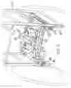 Fig. 09 - Skin pressure reduction to prevent decubitus ulcers by partial magnetic levitation