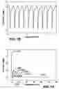 Fig. 12 - Blood pump system and method of operation