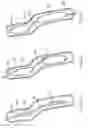 Fig. 03 - Long term ambulatory intro-aortic balloon pump with percutaneous access device