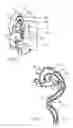 Fig. 06 - Long term ambulatory intro-aortic balloon pump with percutaneous access device