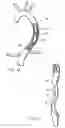 Fig. 10 - Long term ambulatory intro-aortic balloon pump with percutaneous access device
