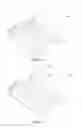 Fig. 06 - Suction Cup Epicardial Stabilizer Device for Cardiac Surgery