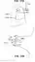 Fig. 07 - PULMONARY PLEURAL STABILIZER