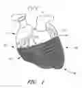 Fig. 02 - HEART FAILURE TREATMENT DEVICE AND METHOD