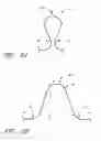 Fig. 03 - HEART FAILURE TREATMENT DEVICE AND METHOD