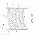 Fig. 06 - HEART FAILURE TREATMENT DEVICE AND METHOD