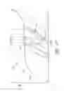 Fig. 16 - HEART FAILURE TREATMENT DEVICE AND METHOD