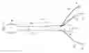 Fig. 01 - INSERTION ASSISTING TOOL