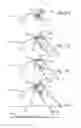 Fig. 04 - Methods and apparatus for treating disorders of the ear nose and throat