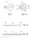 Fig. 05 - Methods and apparatus for treating disorders of the ear nose and throat