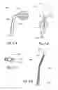 Fig. 06 - Methods and apparatus for treating disorders of the ear nose and throat