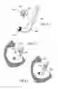Fig. 10 - Methods and apparatus for treating disorders of the ear nose and throat
