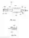 Fig. 12 - Methods and apparatus for treating disorders of the ear nose and throat