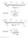 Fig. 20 - Methods and apparatus for treating disorders of the ear nose and throat