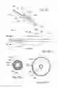 Fig. 24 - Methods and apparatus for treating disorders of the ear nose and throat