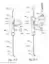 Fig. 32 - Methods and apparatus for treating disorders of the ear nose and throat