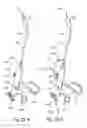 Fig. 34 - Methods and apparatus for treating disorders of the ear nose and throat