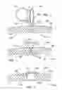 Fig. 07 - Surgical retractor