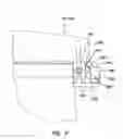 Fig. 09 - Surgical retractor