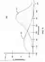 Fig. 11 - System and method for a non-invasive medical sensor