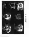 Fig. 12 - Method and apparatus for improving and/or validating 3D segmentations