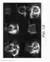 Fig. 13 - Method and apparatus for improving and/or validating 3D segmentations